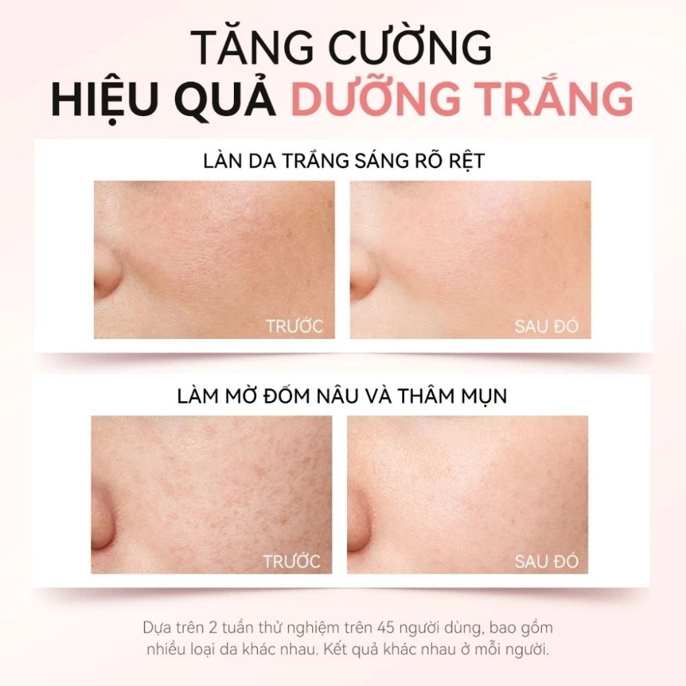 Ảnh 4 của Kem dưỡng da FOCALSKIN BRIGHTVNING CREAM giúp cung cấp độ ẩm cho da, dưỡng trắng da 30g.