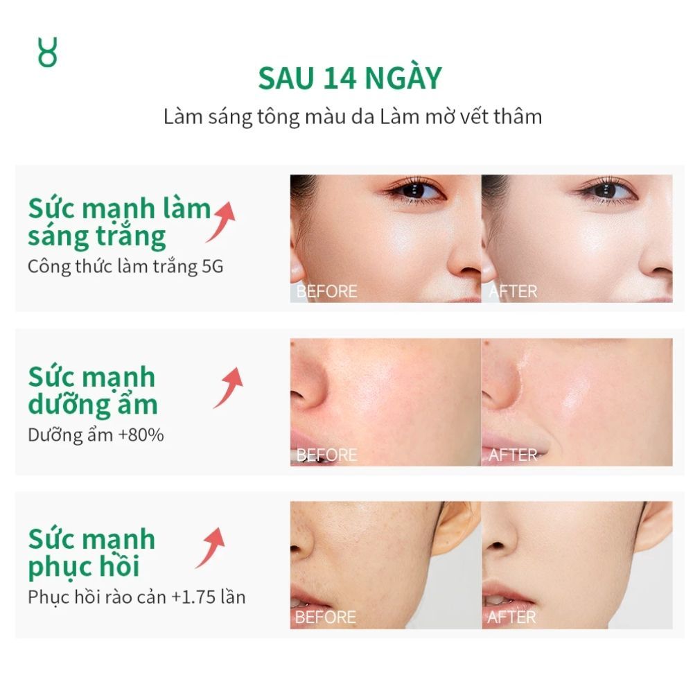 Ảnh 5 của Kem dưỡng da FOCALSKIN BRIGHTVNING CREAM giúp cung cấp độ ẩm cho da, dưỡng trắng da 30g.