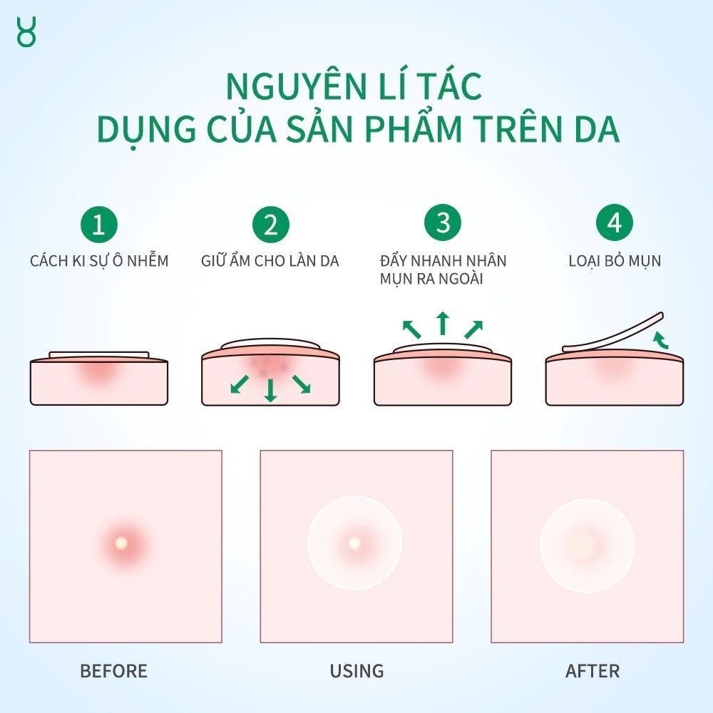 Ảnh 6 của Miếng dán mụn FOCALSKIN ACNE PIMPLE PATCH DAY NIGHT  bảo vệ da khỏi bụi bẩn, giảm sưng.