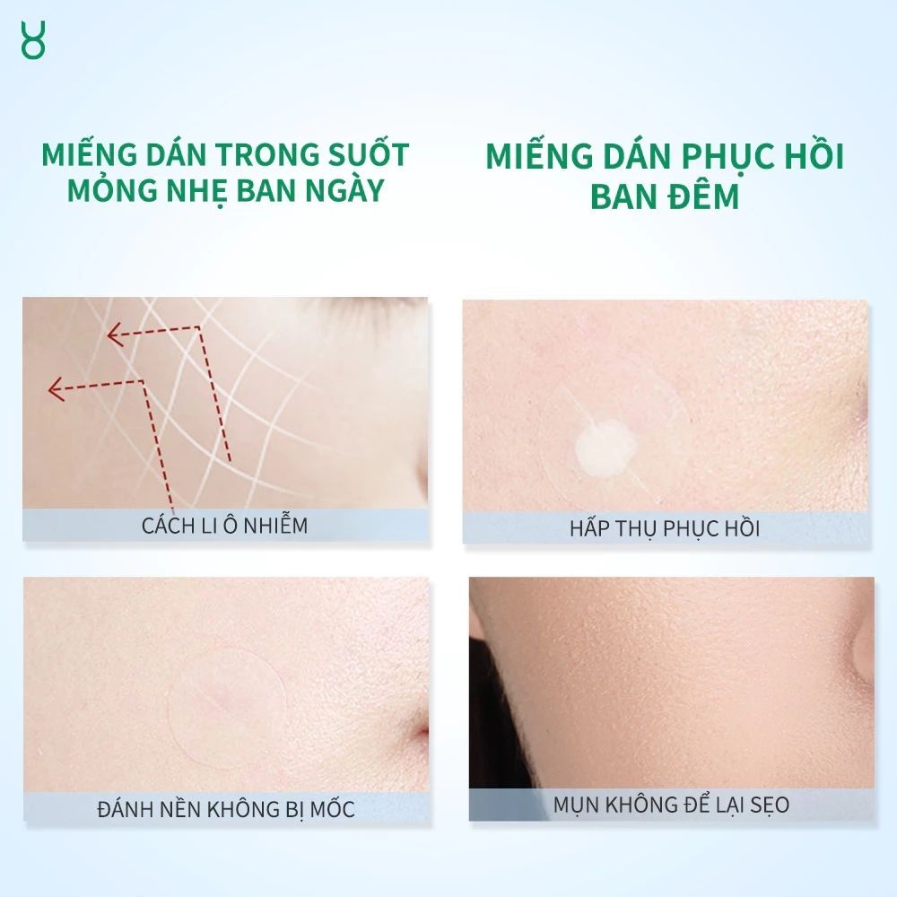 Ảnh 3 của Miếng dán mụn FOCALSKIN ACNE PIMPLE PATCH DAY NIGHT  bảo vệ da khỏi bụi bẩn, giảm sưng.
