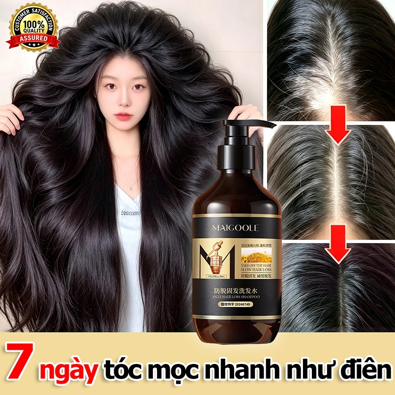 Dầu gội kích thích mọc tóc 400ml mọc tóc Giảm Gãy Rụng Dầu Gội Mọc Tóc Nhanh kiểm soát dầu loại bỏ gàu
