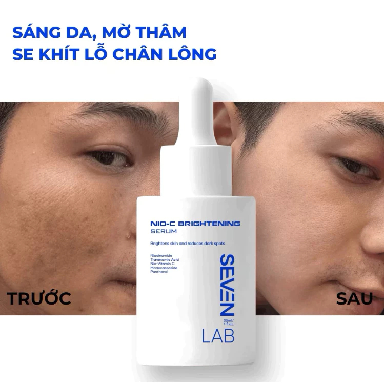 Serum dưỡng trắng nam giới Nio-Vitamin C SEVENLAB dưỡng sáng, mờ thâm vượt trội 30ml