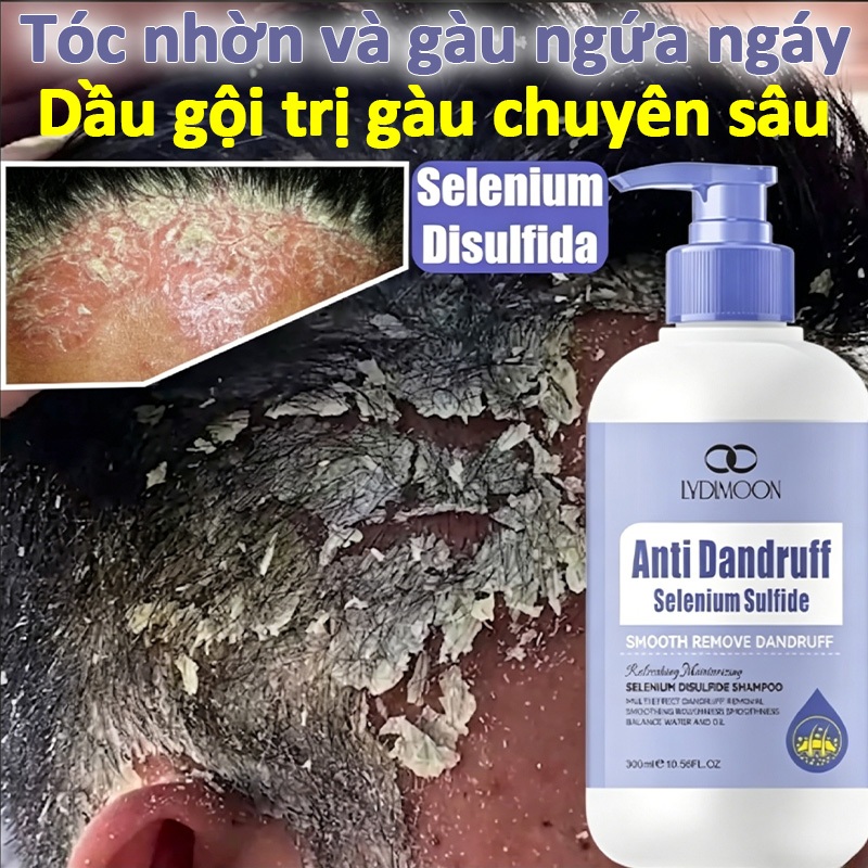 Dầu gội Selen sunfua sạch gàu giảm ngứa - LYDIMOON chính hãng kiềm dầu bồng bềnh, không hormone - 30