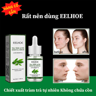 Tinh chất dầu tràm trà cải thiện mụn giảm thâm mụn làm sạch da dịu nhẹ dưỡng phục da