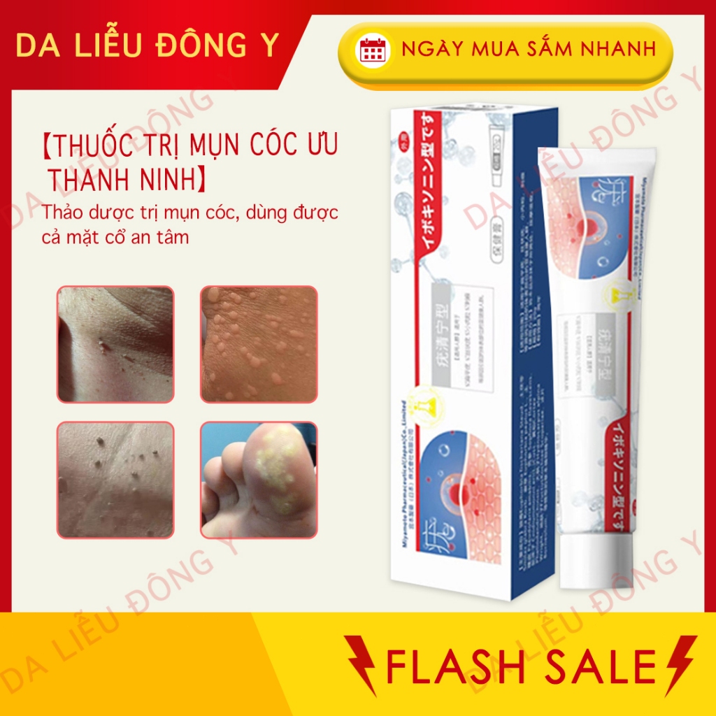 Kem bôi loại bỏ mụn thịt, mụn nhỏ ở cổ, mụn cóc, nách – Dưỡng da làm đẹp. 【Mua 2 tặng 1】