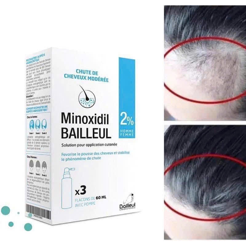 Xịt Mọc Tóc Minoxidil Bailleul 2%,5% [Date 2028] Chai 60 ml, Xuất Xứ Pháp, TONY MART