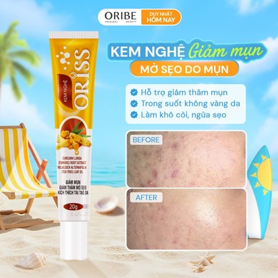 Kem nghệ Oriss giảm mụn và thâm không gây vàng da dành cho da dầu mụn tuýp 20gr