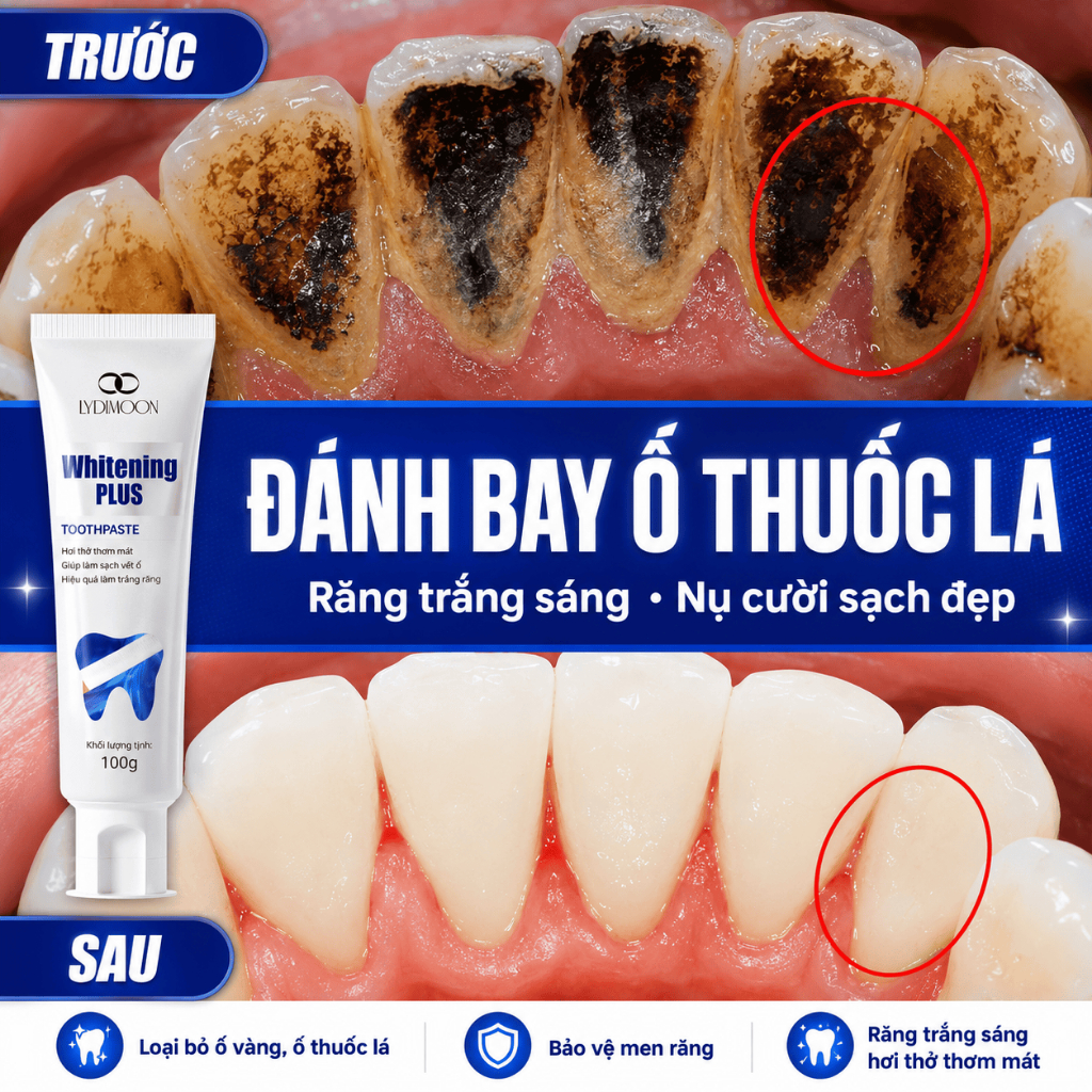 Kem Đánh Răng Trắng Răng LYDIMOON 100g Làm Sạch Vết Ố, Ố Vàng, Mảng Bám, Giúp Hơi Thở Thơm Mát