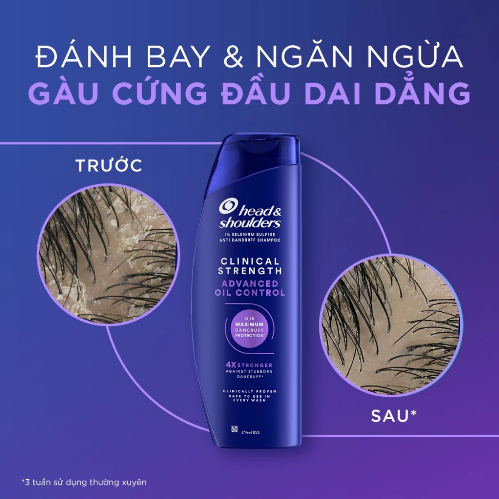 Ảnh 7 của Dầu Gội Mỹ Head&Shoulders Clinical Dành Cho Da Đầu Gàu, Ngứa, Da Khô, Dầu Nhờn 400ml