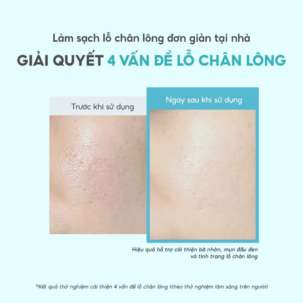 Ảnh 8 của Mặt Nạ Đất Sét Aperire Spa Relief Pore Mask, Làm Sạch Sâu Dầu Nhờn, Mặt Nạ Thu Nhỏ Lỗ Chân Lông 120g