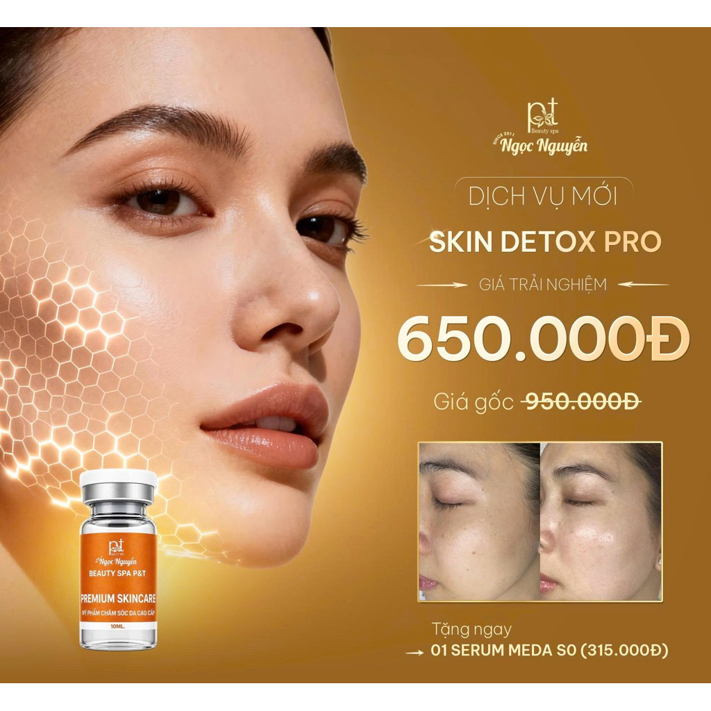 HCM [E-voucher] LẤY NHÂN MỤN KHÔNG ĐAU