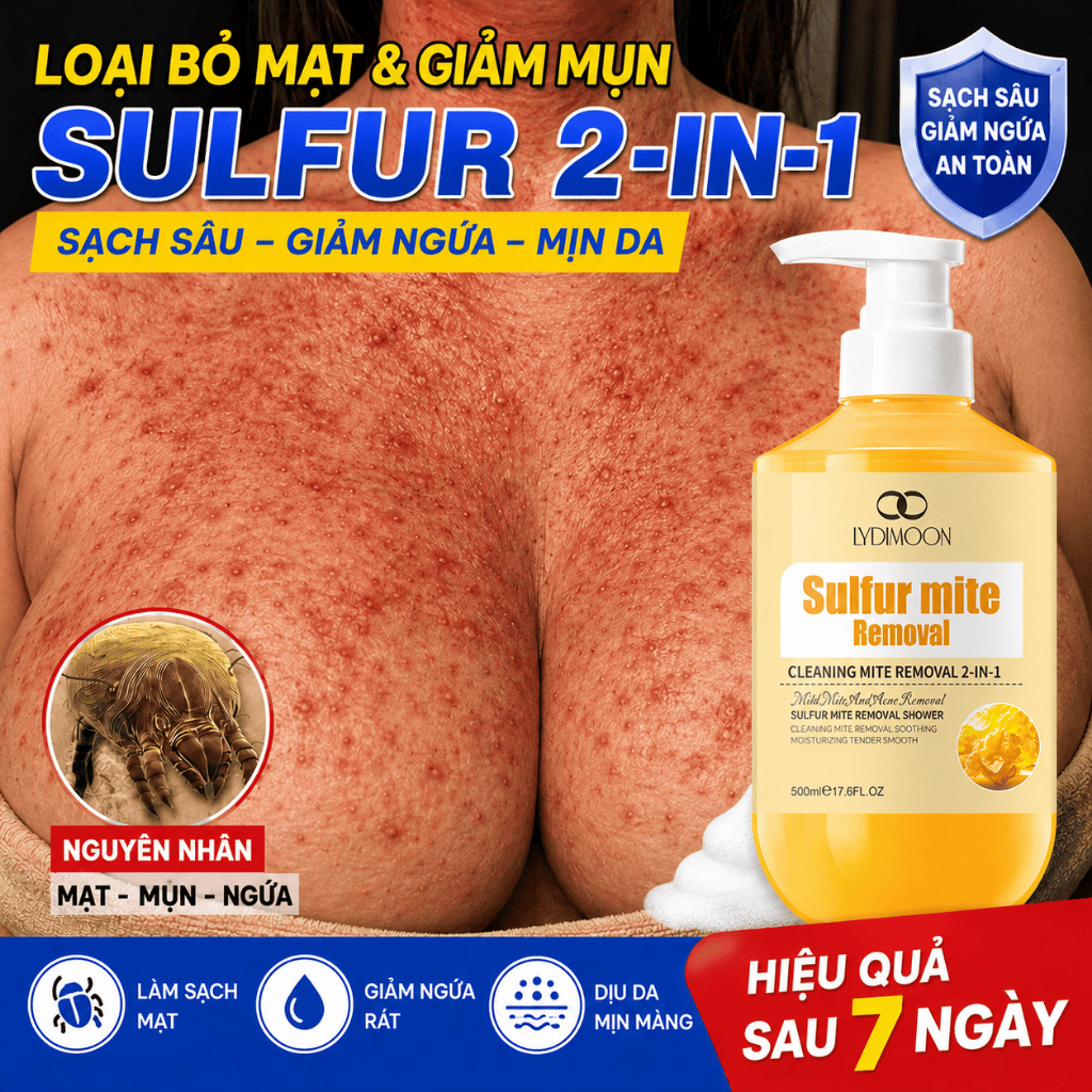 Sữa tắm diệt bọ ve LYDIMOON 500ml - lưu huỳnh giảm mụn lưng, kiềm dầu, sạch sâu, dịu nhẹ chính hãng