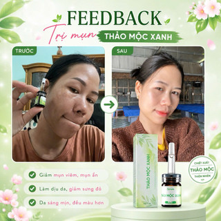 Combo Serum Thảo Mộc Xanh  ( 1 SRM - 1 Xanh) tặng gói TDC