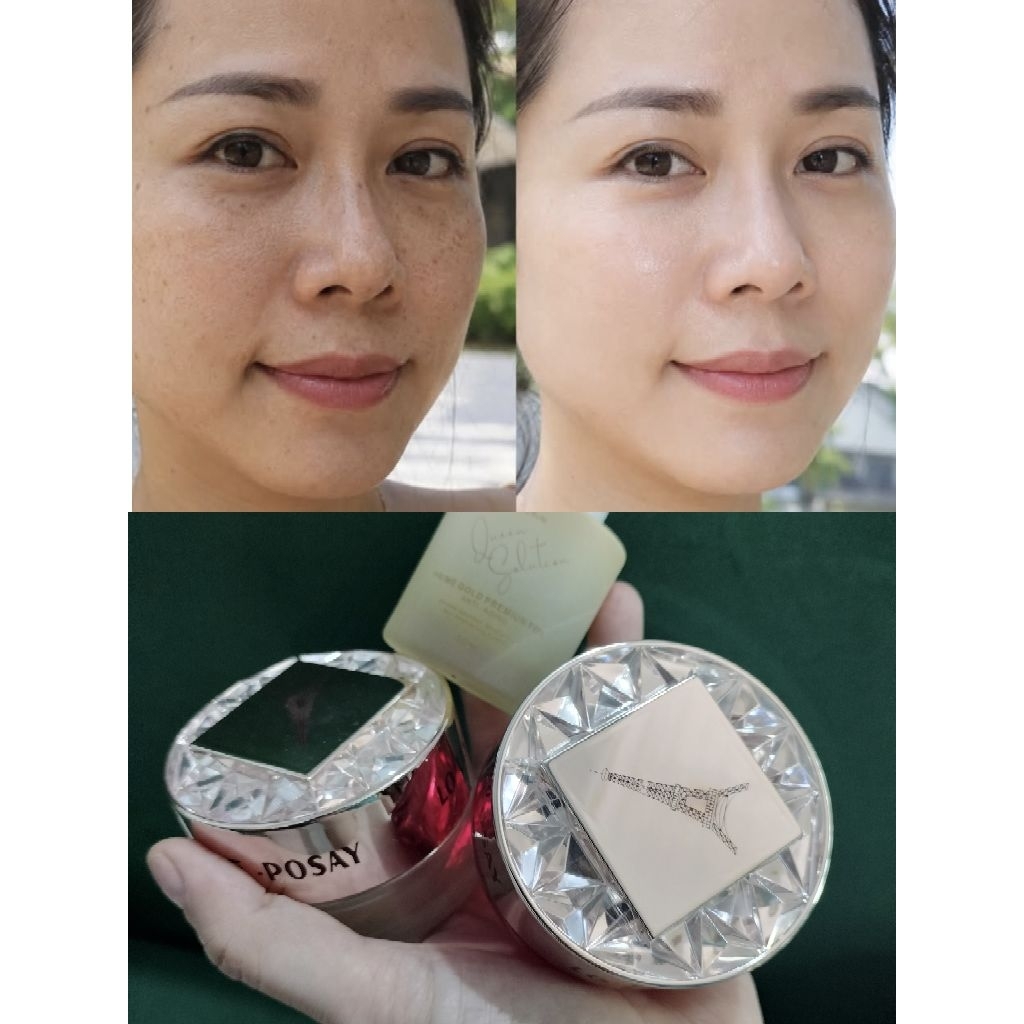 ( Chính Hãng )Kem Dưỡng Làm Sạch Nám Da, Dưỡng Trắng Da Posy Pháp