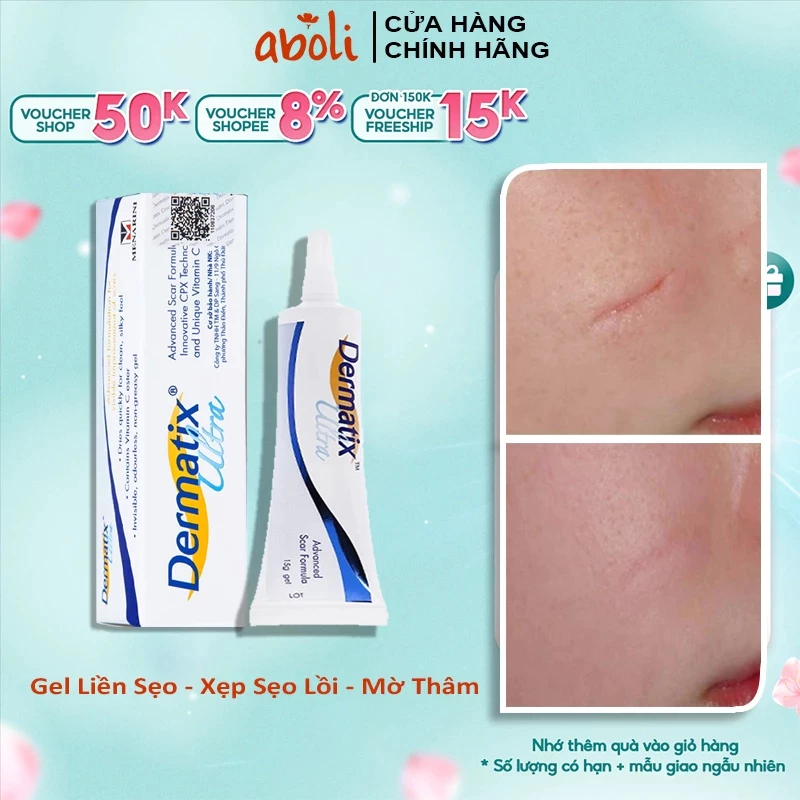 Gel Sẹo Dermatix Ultra 15g - Kem Sẹo Dermatix Gel Lành Liền Phẳng Sẹo Lòi, Sẹo Lõm