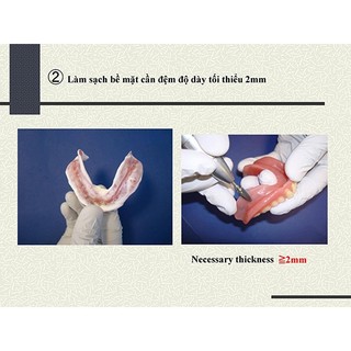 Nhựa Đệm Hàm DIL nhỏ (Bộ)