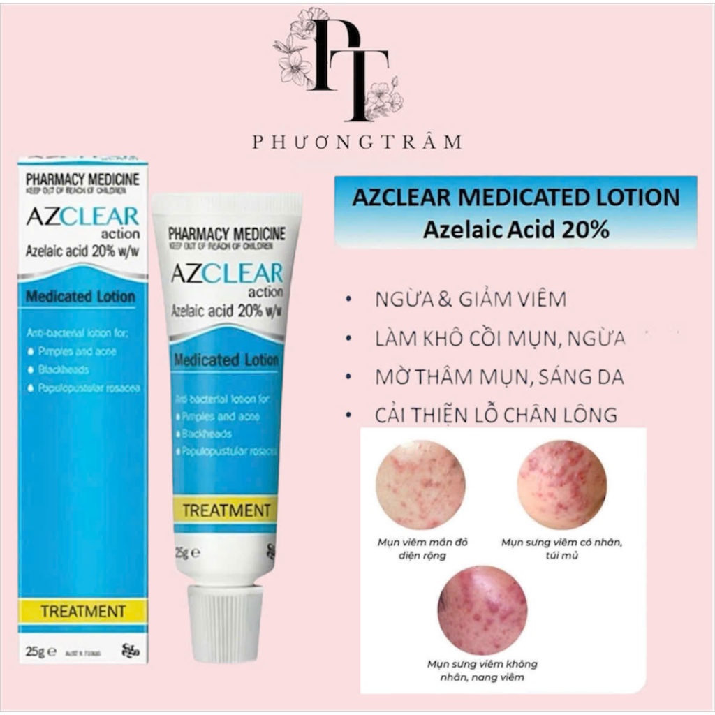 Kem mờ thâm Azclear 20% Azelaic acid Lotion giảm mụn, mờ thâm 25g