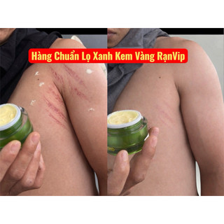 KEM RẠN DA MULTI PRO TẶNG KÈM QUÀ