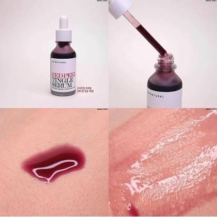 Peel giảm thâm trắng sáng da mặt và body Red peel So Natural Red Peel Tingle Serum