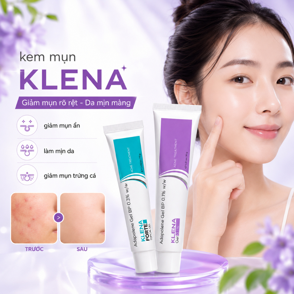 Gel giảm mụn Klena Forte, kem mụn Adapalene 0.1, 0.3 hỗ trợ giảm mụn ẩn, mụn trứng cá, mờ thâm giúp 