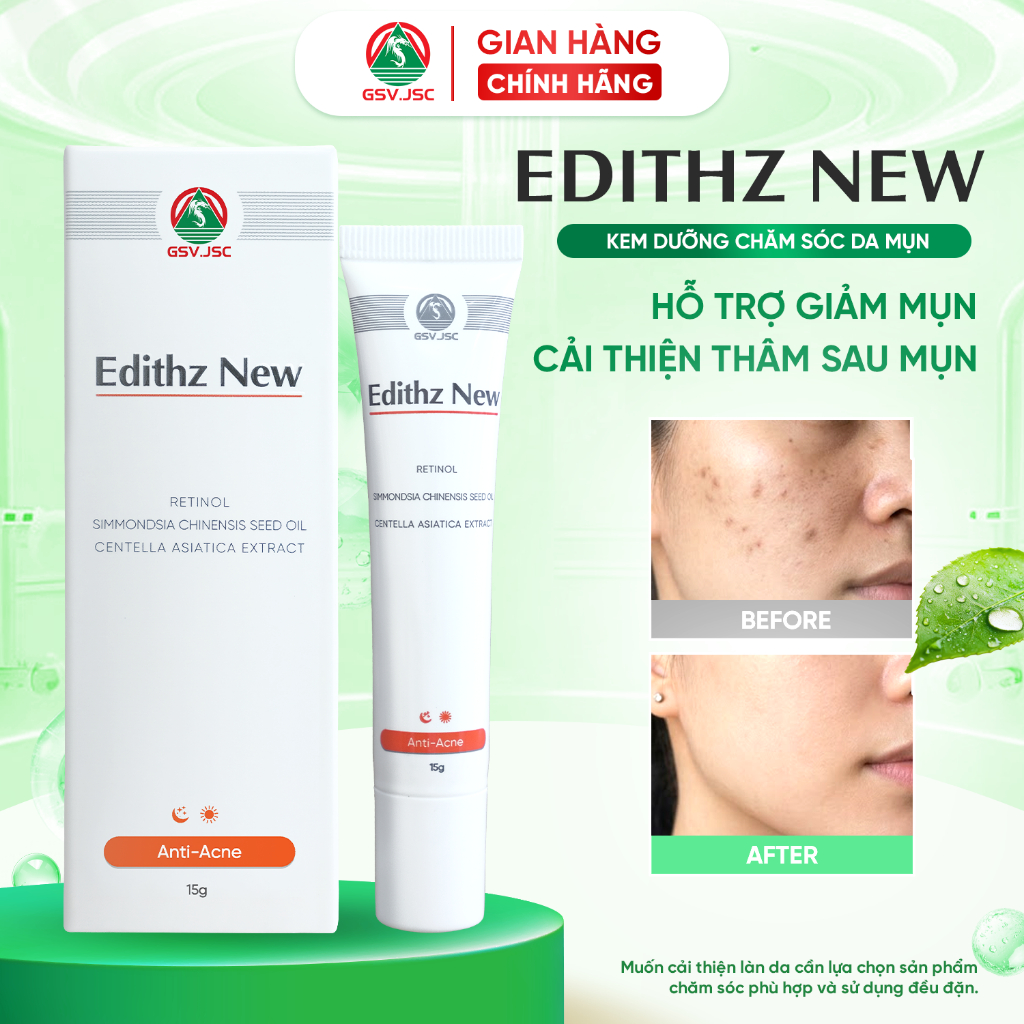 Edithz New Kem bôi ngăn ngừa và làm giảm mụn trứng cá, mụn ẩn, mụn đầu đen, mụn đầu trắng