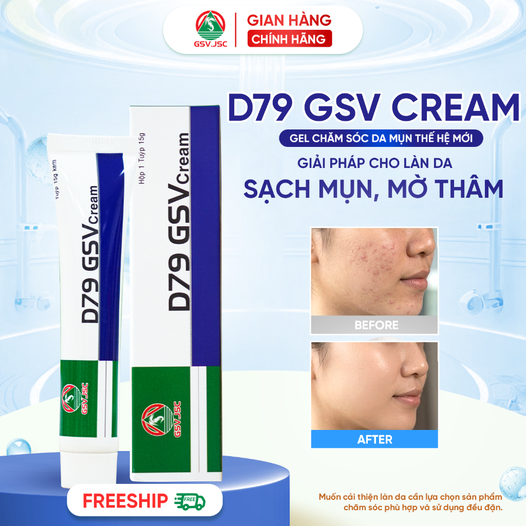 D79 GSV Cream Giúp Ngăn Ngừa Mụn, Mờ Thâm, Kiểm Soát Dầu Nhờn (Mới)