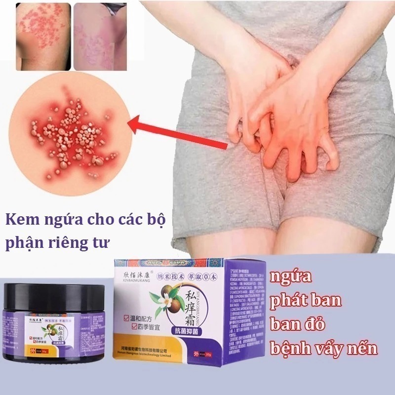 kem bôi da hắc lào 30gkem bôi ngứa kem bôi nấm ngứa nhật bản kem bôi ngứa da bôi hắc lào nấm ngứa ke