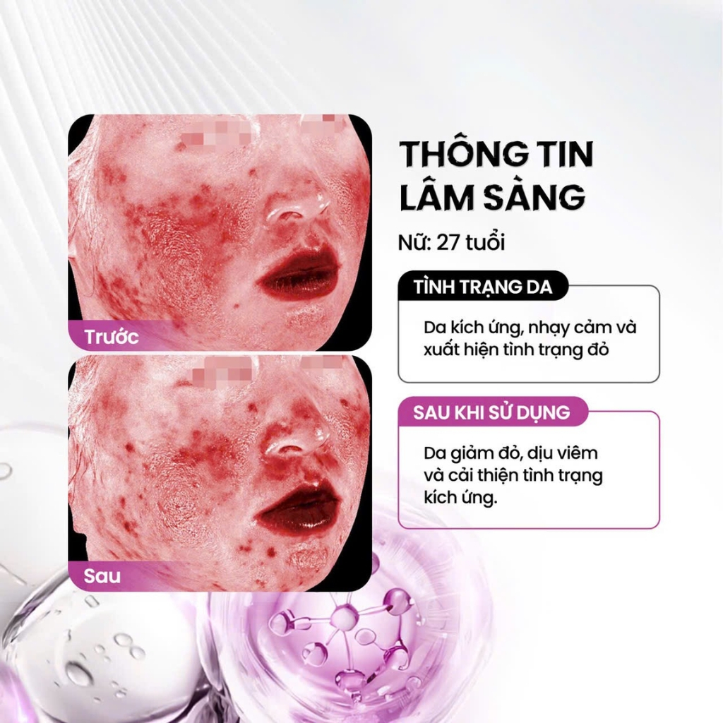 (có quà tặng) Serum Peptide Phục Hồi Đa Tầng Và Giảm Đỏ Chuyên Sâu MD CARE Peptide Bioactiv Matrix Serum 30ml | BigBuy360 - bigbuy360.vn