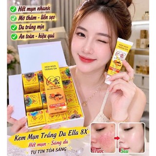 [HCM] Kem ngừa Mụn Trắng Da Ella 8X