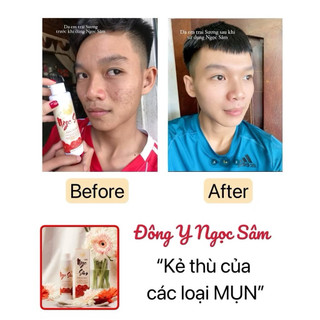 ngọc sâm chính hãng 50ml (CÒN HÀNG )