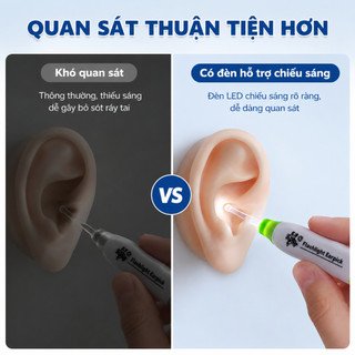 Dụng Cụ Lấy Ráy Tai Có Đèn LED Quan Sát Dễ Dàng Vệ Sinh Tai Đầu Lấy Ráy Silicon Mềm Cho Bé Và Gia Đình