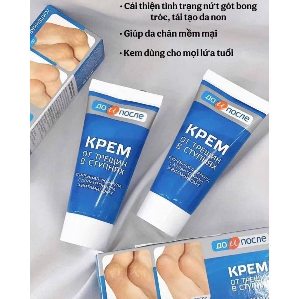 Kem nứt gót chân Kpem Hàng Chính Hãng