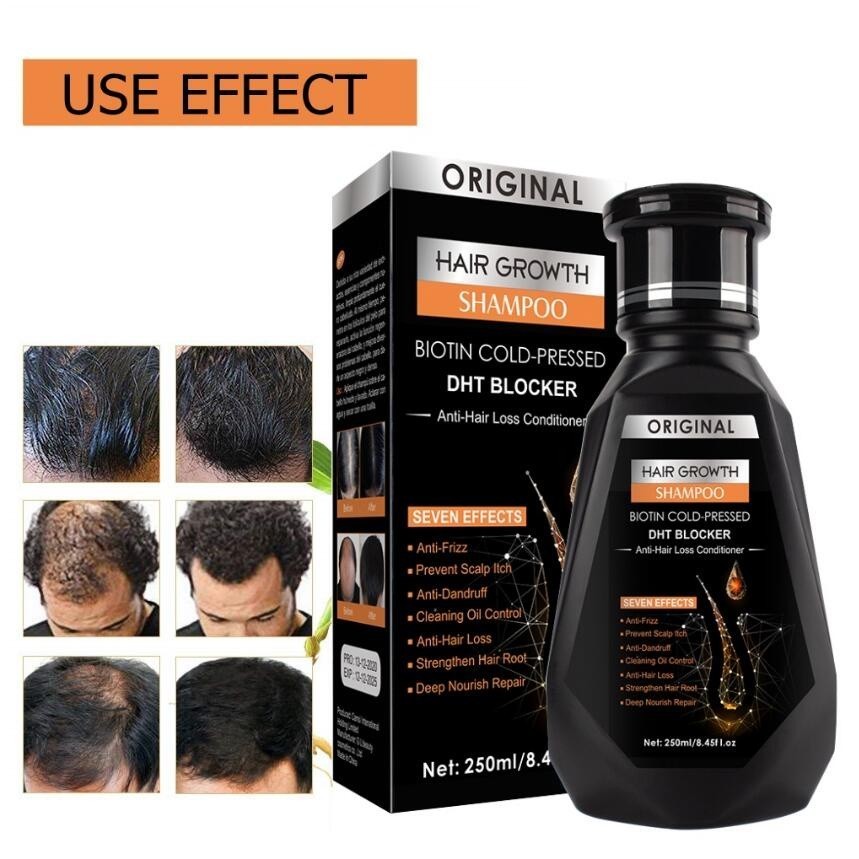 Dầu Gội Thảo Mộc DHT Blocker Giảm Rụng Tóc, Hỗ Trợ Mọc Tóc Hair Growth Shampoo