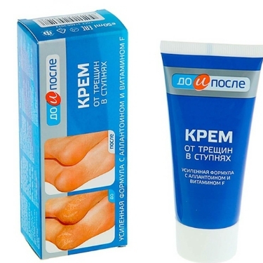 Kem dưỡng da chân "Before & After KPEM 50ml