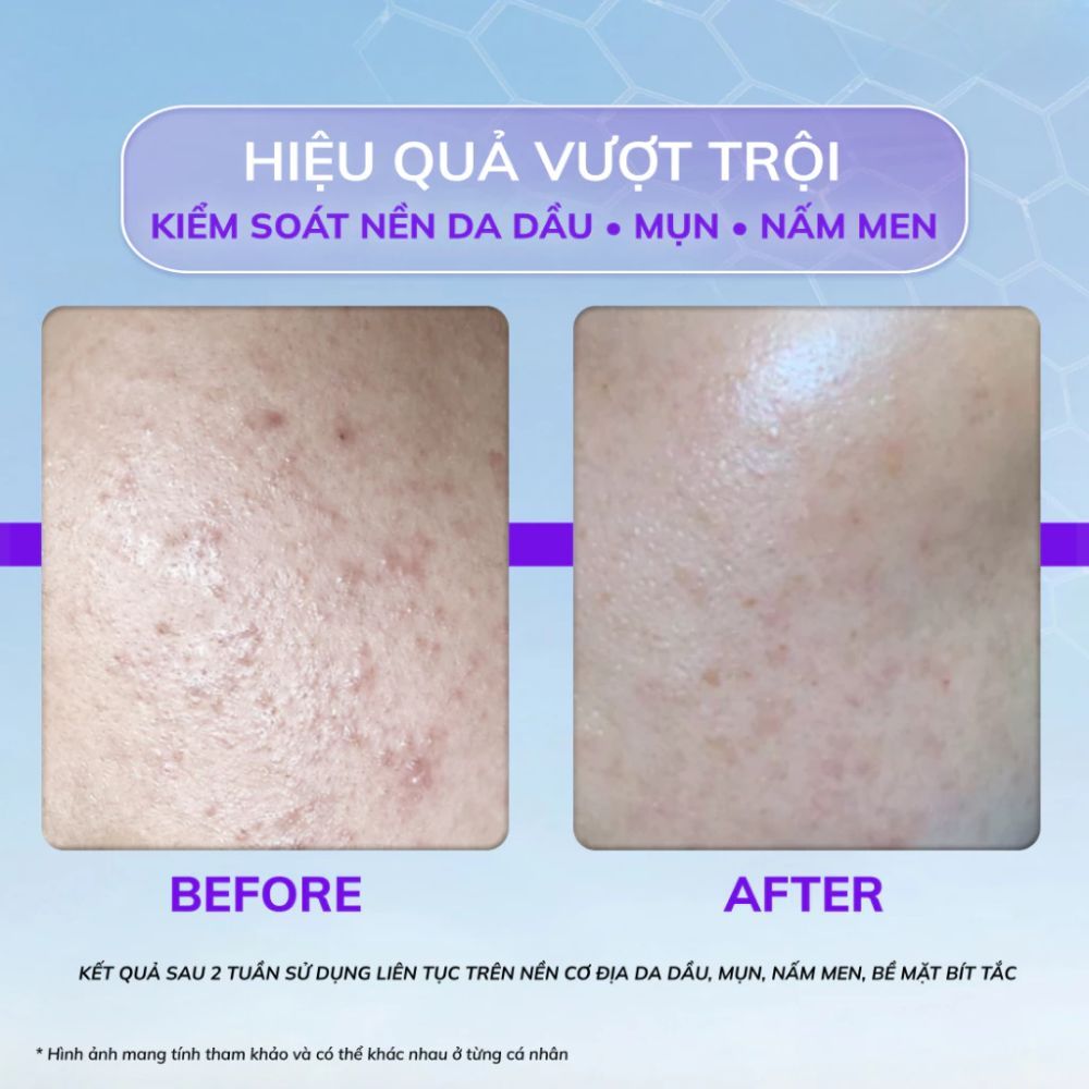 Ảnh 7 của Sữa rửa mặt Dermarium Good Night Cleanser, The Waves làm sạch cho da dầu mụn dịu nhẹ