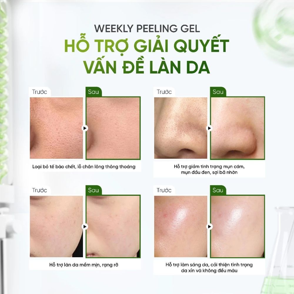 Ảnh 4 của Tẩy Tế Bào Chết DAILY EFFECT Weekly Peeling Gel hỗ trợ làm sạch lỗ chân lông, bã nhờn cho da dầu mụn