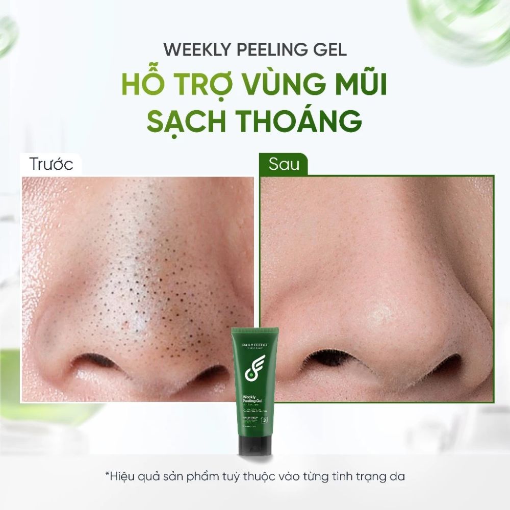 Ảnh 5 của Tẩy Tế Bào Chết DAILY EFFECT Weekly Peeling Gel hỗ trợ làm sạch lỗ chân lông, bã nhờn cho da dầu mụn