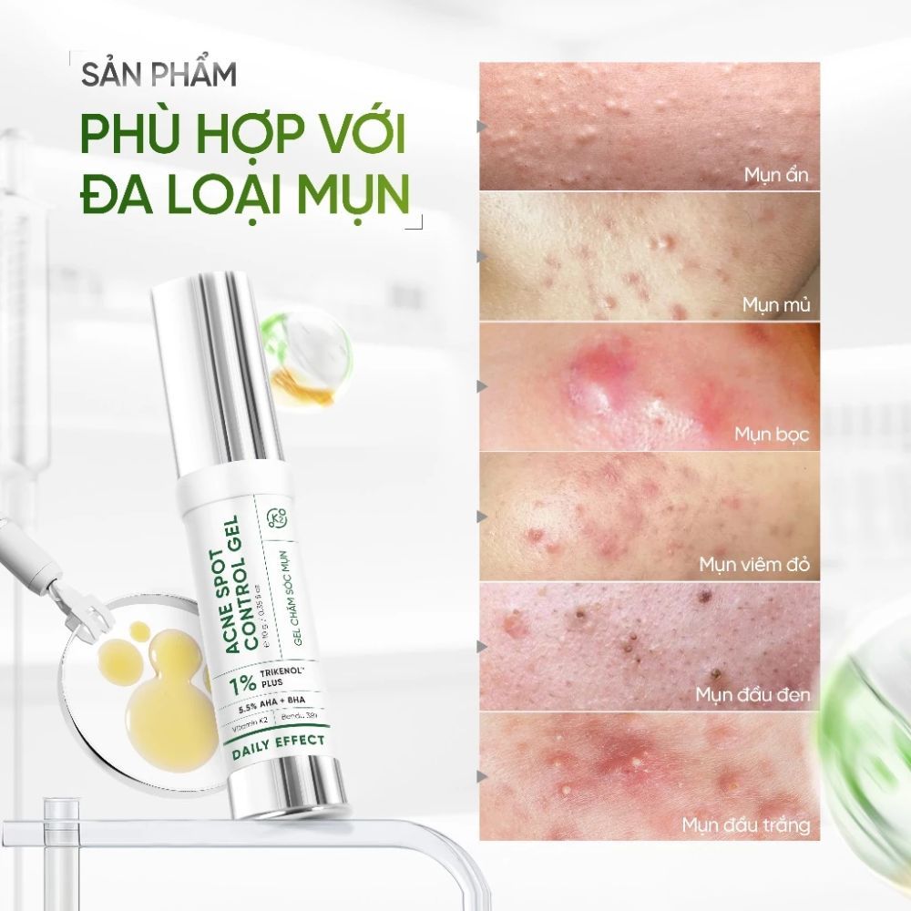 Ảnh 6 của Gel Chấm Mụn DAILY EFFECT Acne Spot Control Gel hỗ trợ giảm mụn , giảm thâm 5g/10g