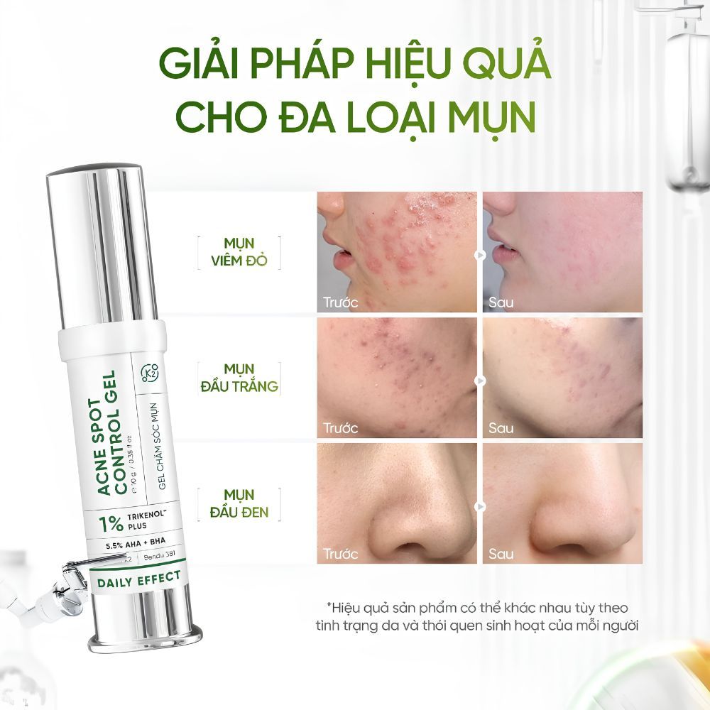 Ảnh 7 của Gel Chấm Mụn DAILY EFFECT Acne Spot Control Gel hỗ trợ giảm mụn , giảm thâm 5g/10g