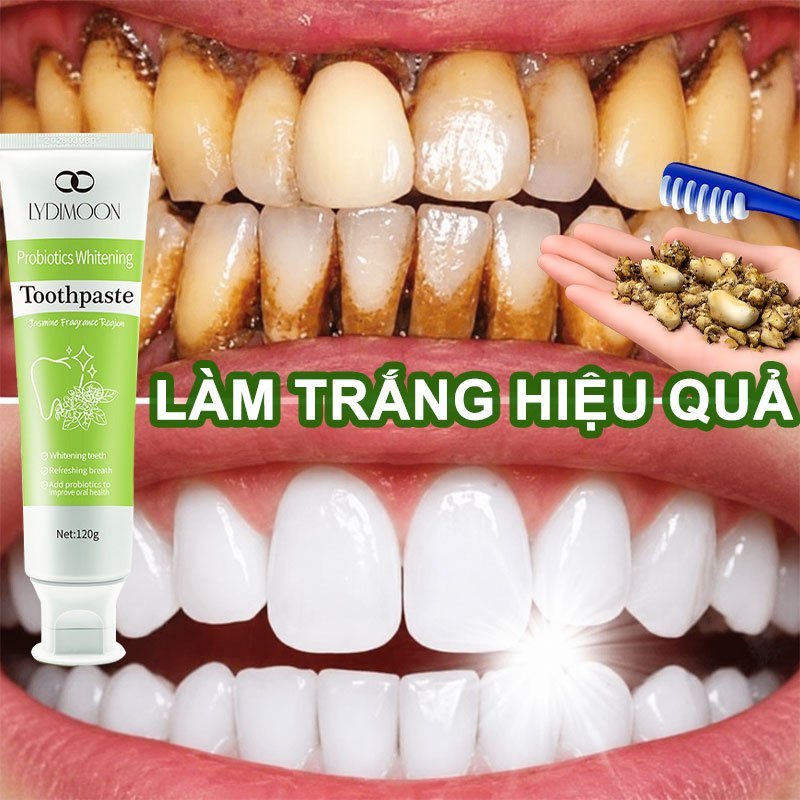 Kem đánh răng LYDIMOON trắng răng 120g, làm sạch vết ố, men vi sinh, thơm miệng, chăm sóc răng miệng
