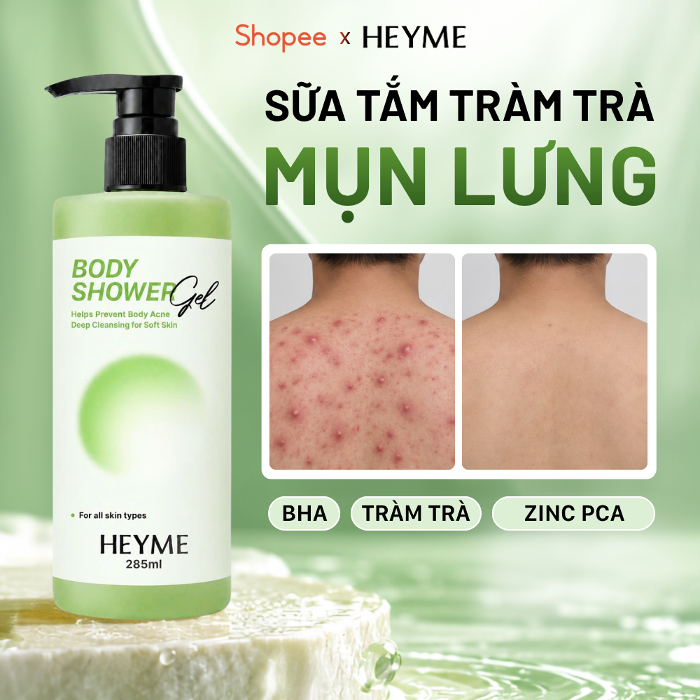 Sữa tắm giảm mụn lưng Heyme BodyShower Gel- 285ml - Hỗ trợ giảm mụn lưng, mụn cơ thể