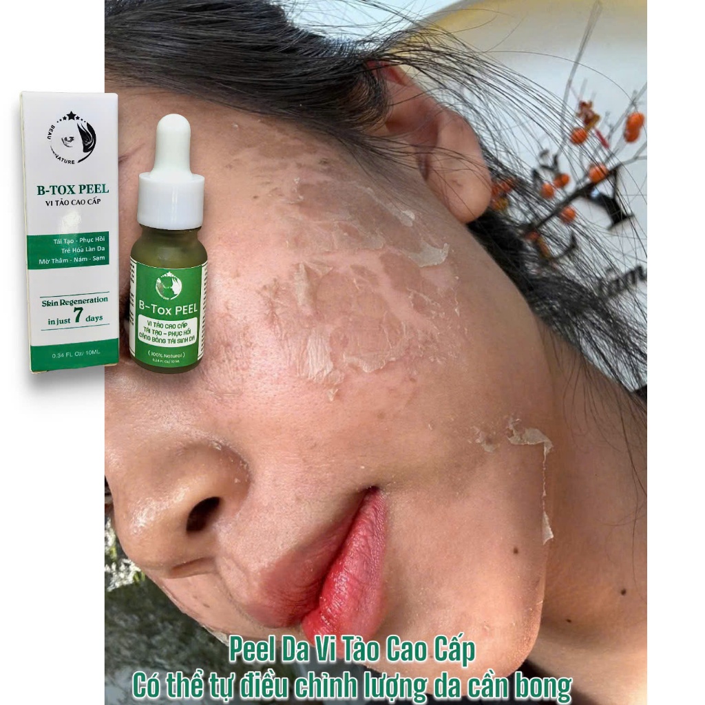 B-tox Peel Da Mặt Vi Tảo Cao Cấp - 10ml - ( giảm mụn thâm nám tàn nhang - Peel da mặt yubi80 )