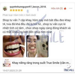 Khay niềng răng trong suốt True Smile (cần mẫu hàm răng )