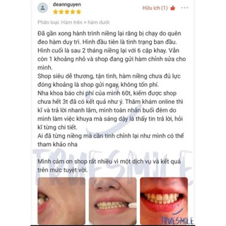 Khay niềng răng trong suốt True Smile (cần mẫu hàm răng )