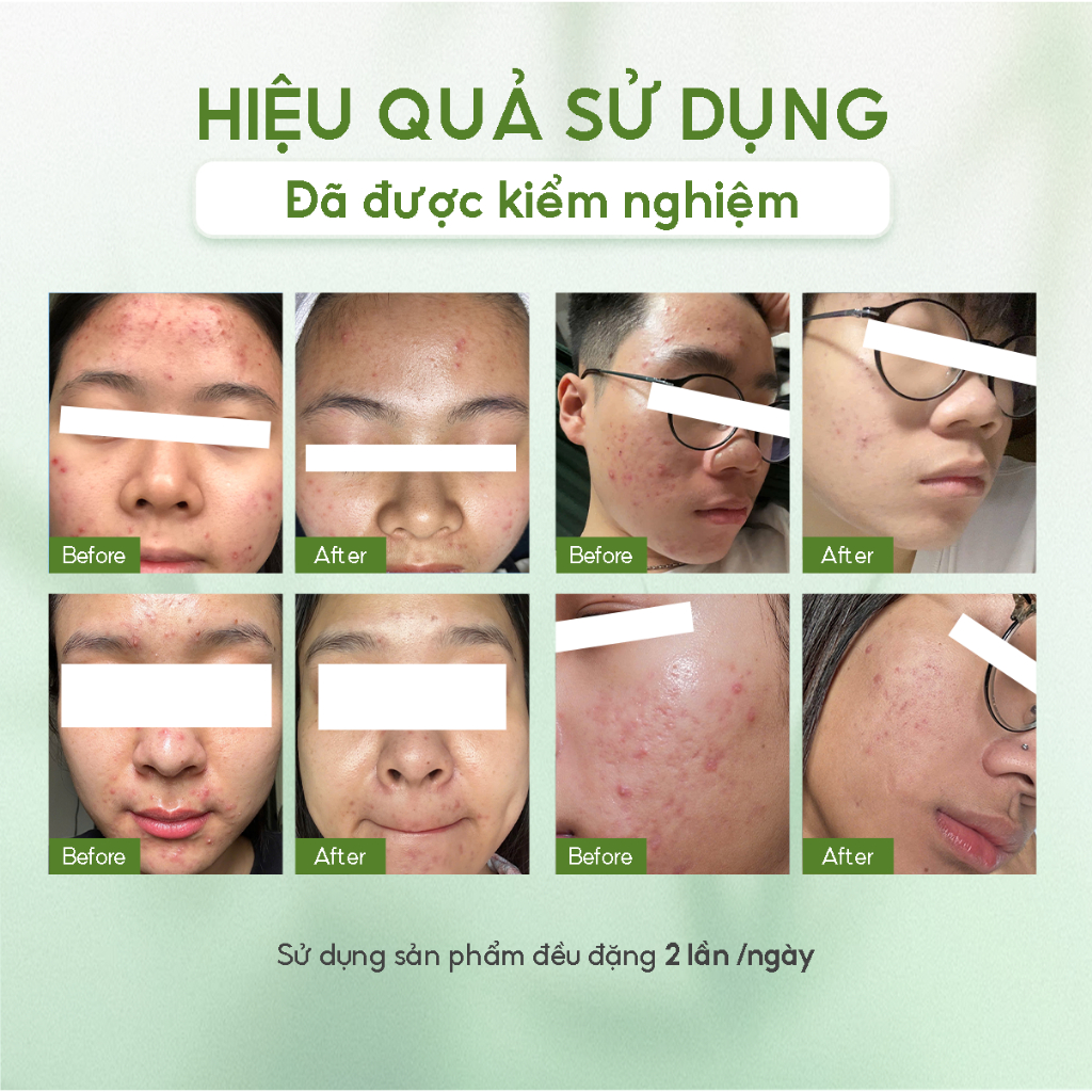 Toner dập viêm dịu da MEIDEME Green Salvia Treatment Toner 200ml | BigBuy360 - bigbuy360.vn