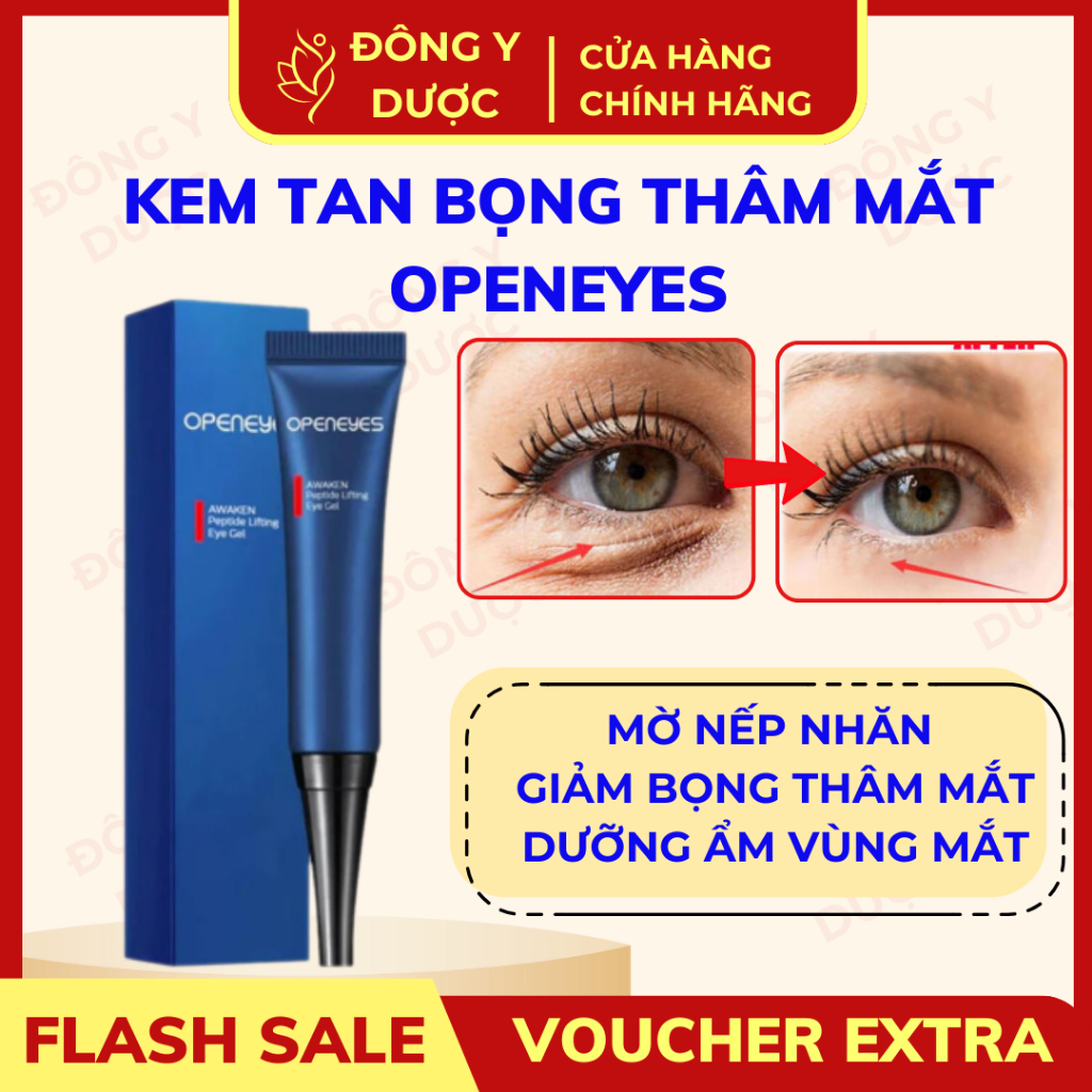 Kem Dưỡng Vùng Mắt OPENEYES - Hỗ Trợ Làm Mờ Quầng Thâm, Dưỡng Ẩm Giảm Bọng Mắt, Nếp Nhăn 15g