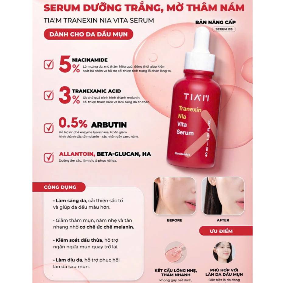 Serum Dưỡng Trắng, Mờ Thâm Nám Tia’m Tranexin Nia Vita Serum Dành Cho Da Dầu Mụn 40ml Tiam