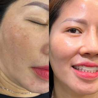 Thước Cong C