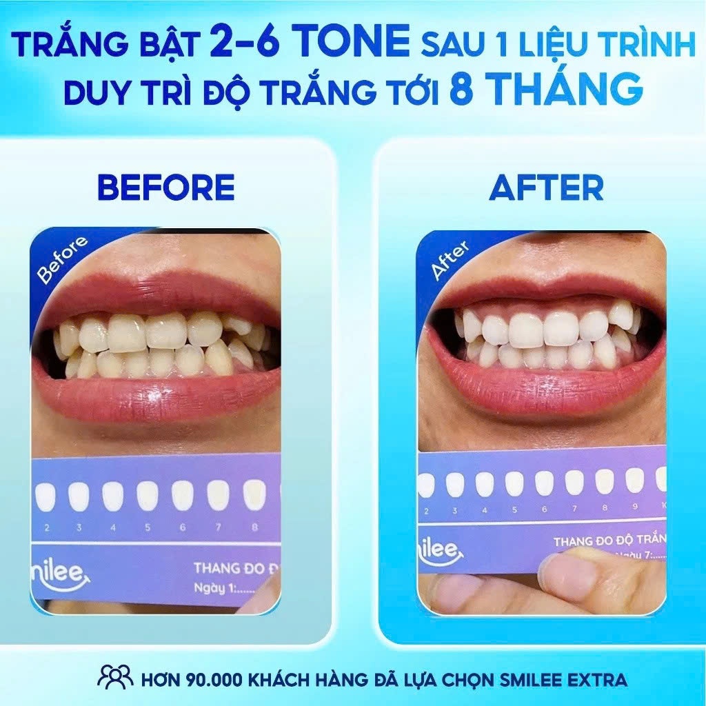 [GIÁ 438K TẠI LIVE SHOP] Trắng răng Smilee Max, bộ kit làm trắng răng từ 2 đến 6 tone sau 1 liệu trình an toàn răng nướu | BigBuy360 - bigbuy360.vn