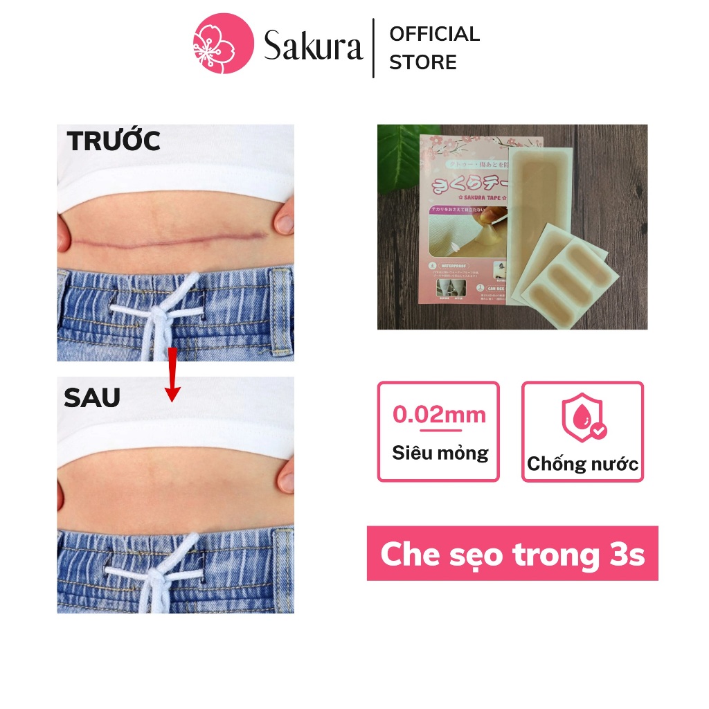Miếng dán che sẹo che khuyết điểm Nhật Bản Sakura tiệp màu da, nhiều size nhiều màu